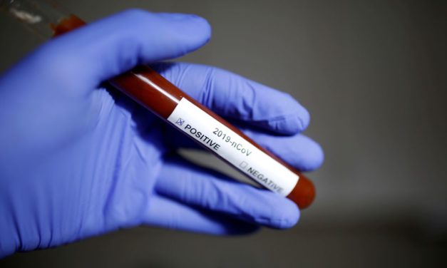 São Paulo confirma primeiro caso de reinfecção por Covid-19