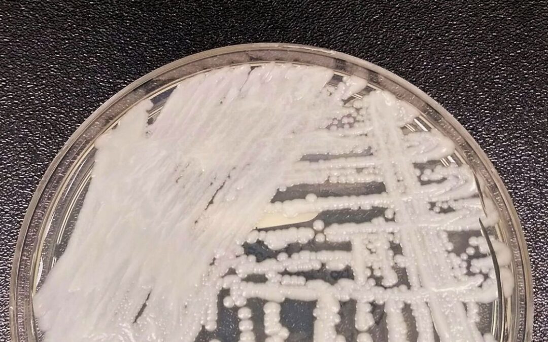 Fiocruz e Pasteur vão pesquisar sobre danos dos fungos no ser humano