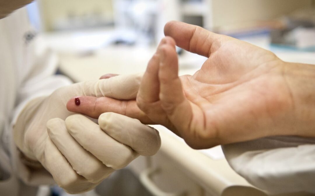 Justiça proíbe exigência de teste HIV para candidatos a concursos