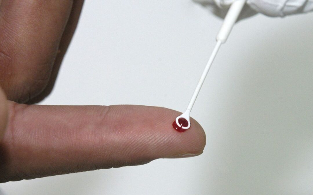 PrEP: tratamento preventivo é alternativa no combate ao HIV no Brasil