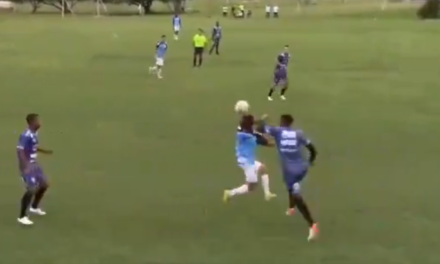 Meia do Sub-20 sofre fratura na mandíbula em jogo-treino